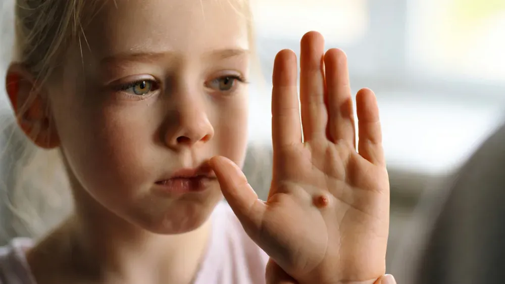 Fröhliches Kind mit gesunder Haut – Kinderhypnose gegen Warzen Augsburg